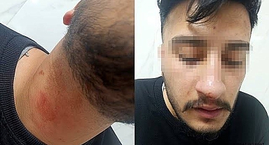 Dicle Elektrik çalışanlarına saldırı olayında yeni gelişme!