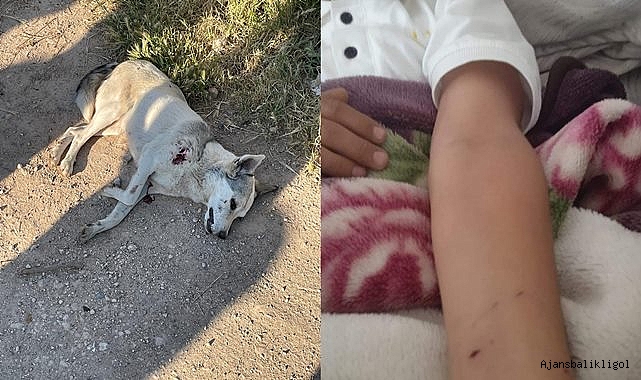 Şanlıurfa’da sokak köpeği çocuğa saldırdı