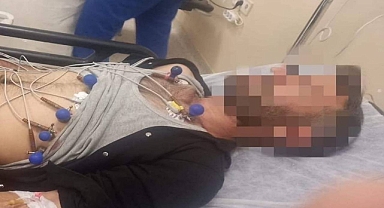 Urfa’da bir şahsı tuvaletten çıkan yılan ısırdı! 