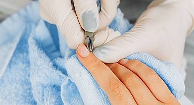 Tırnak Batması Nasıl Tedavi Edilir: Yararlı İpuçları