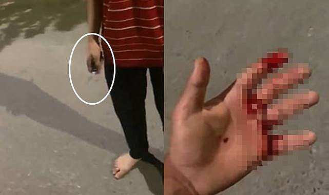 Urfa’da İlçe Başkanının Oğlu Bıçaklandı