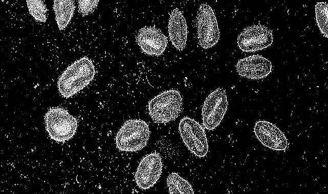 Maymun Çiçeği: Temel Bilgiler, Koruma Stratejileri ve Son Tedaviler