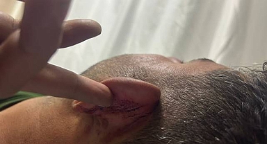 Şanlıurfa Valiliğinden 'Polis İşkence Yaptı' İddiasına Yanıt