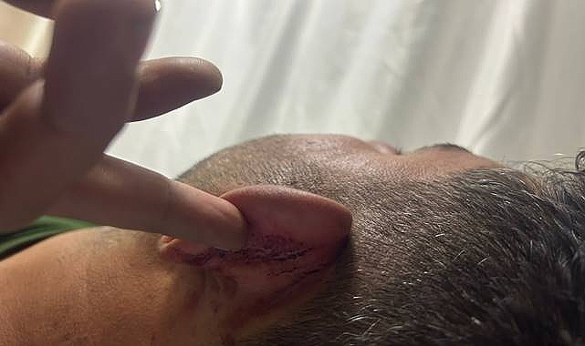 Şanlıurfa Valiliğinden 'Polis İşkence Yaptı' İddiasına Yanıt