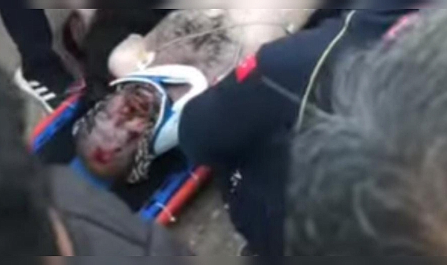 Urfa'da Feci Olay! Elektrik Çarpması Sonucu Can Verdi