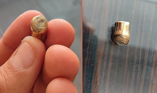 Birecik'te Maganda Kurşunu Seyir Halindeki Aracın Sürücüsünü Yaraladı