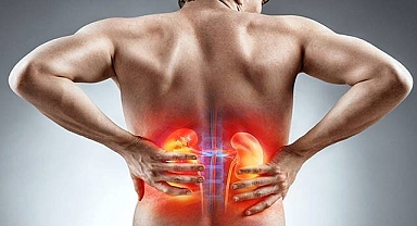 Böbrek Taşına Karşı 8 Etkili Yöntem!