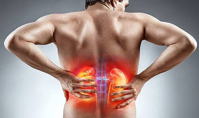 Böbrek Taşına Karşı 8 Etkili Yöntem!