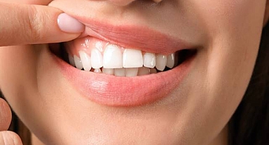 Diş Kanaması Orucu Bozar mı?