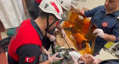 Şanlıurfa’da Korkutan Kaza: Koluna 12’lik Demir Saplandı!