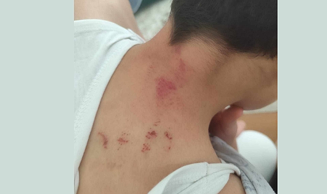 Şanlıurfa’da Skandal: Öğrencisini Darp Eden Öğretmen Tutuklandı