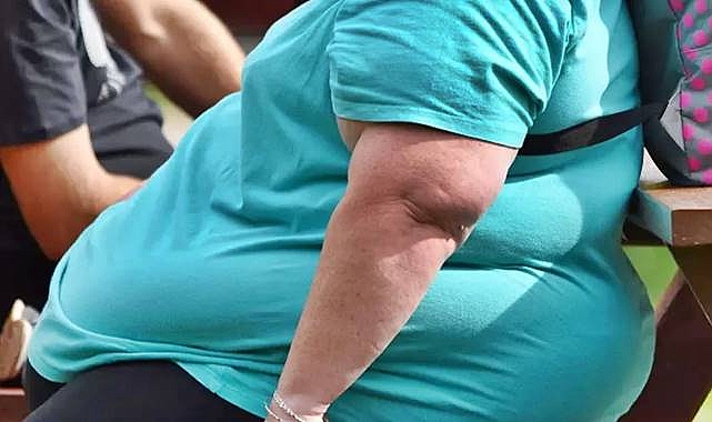 Türkiye’de Obezite Alarm Veriyor: Sayı 20 Milyonu Aştı