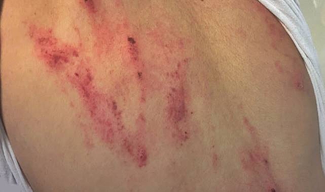 Şanlıurfa’da Vahşet! ŞUSKİ Personeline Köpekli Saldırı