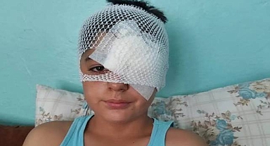 Viranşehir'de Başıboş Köpeklerden Kaçan Çocuğa Araç Çarptı: Kafasına 20 Dikiş Atıldı