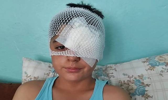 Viranşehir'de Başıboş Köpeklerden Kaçan Çocuğa Araç Çarptı: Kafasına 20 Dikiş Atıldı