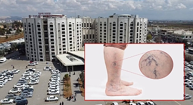 Şanlıurfa Eğitim ve Araştırma Hastanesinde Varis Tedavisinde Yeni Dönem