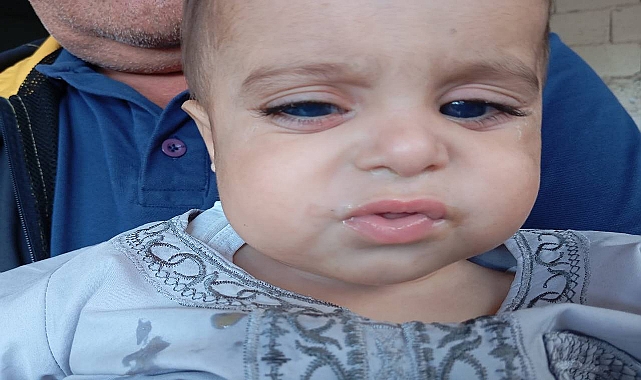 Fecr İnsani Yardım Derneği’nden Görme Engelli Minik İçin Umut Çağrısı