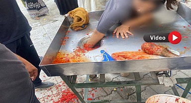 Urfa'da Salça Makinesine Elini Kaptıran Vatandaş, İtfaiye Ekiplerince Kurtarıldı