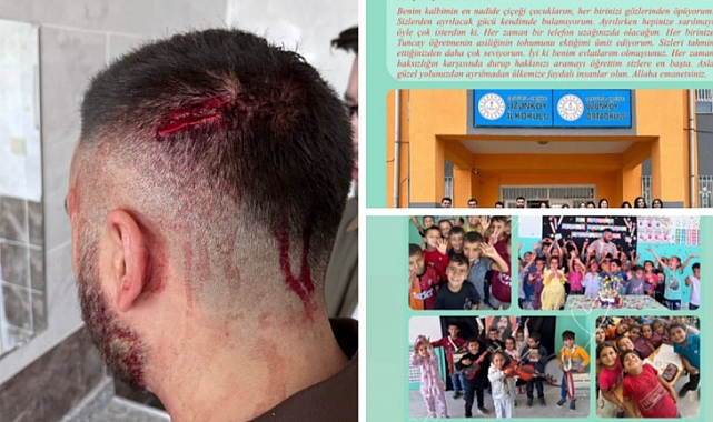 Şanlıurfa’da Öğretmene Saldırı: Şüpheli Tutuklandı