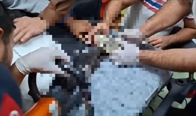 Urfa İtfaiyesi, Eli Kıyma Makinesine Sıkışan Çocuğun Yardımına Koştu