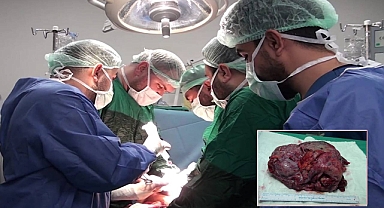 Şanlıurfa’da 25 Santimetrelik Dev Kist Başarıyla Alındı!