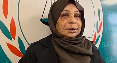 Kadına Şiddet Skandalı: Eşine Şiddet Suçundan Tutuklandı