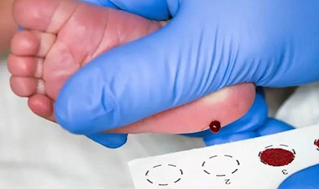 Uzmanından Uyarı: Topuk Kanı Taraması Hayat Kurtarıyor