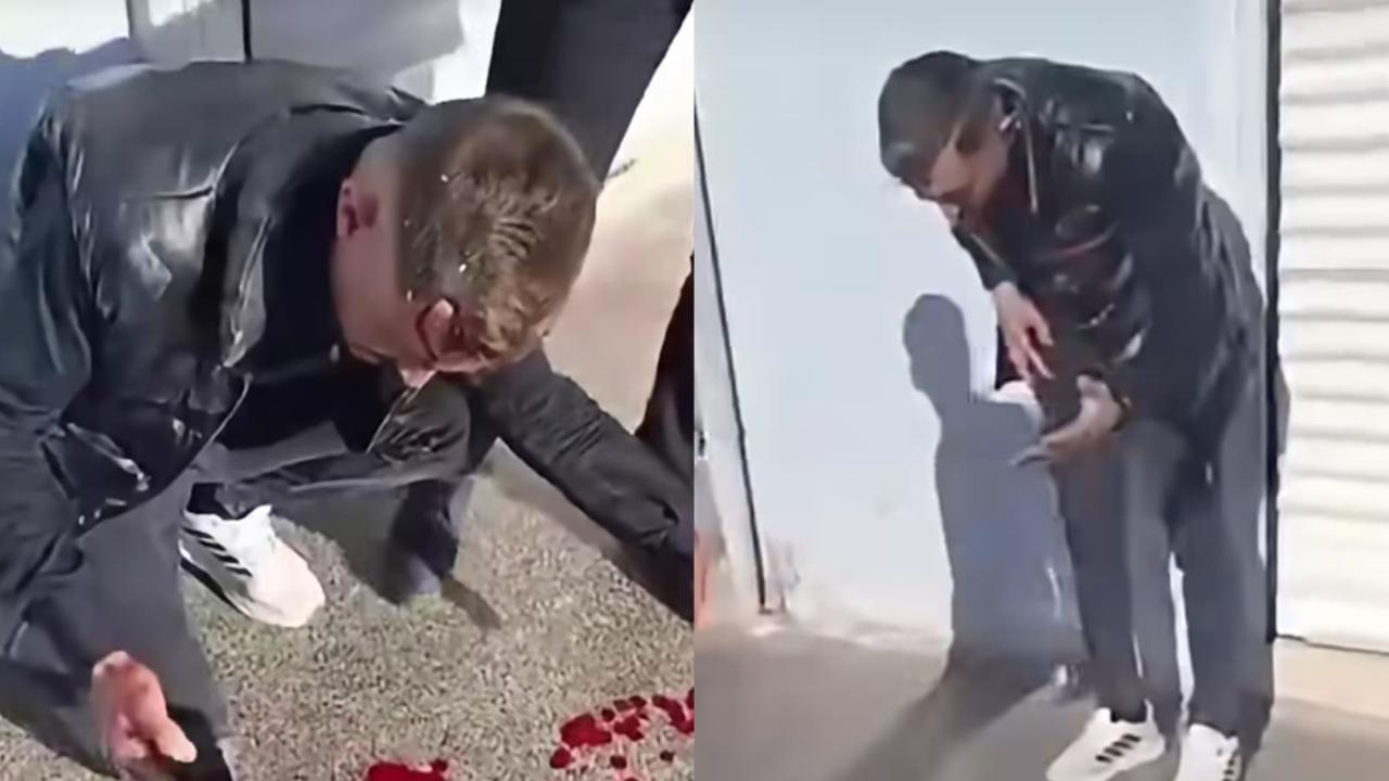 Binadan Kopan Beton Parçası Vatandaşı Ağır Yaraladı