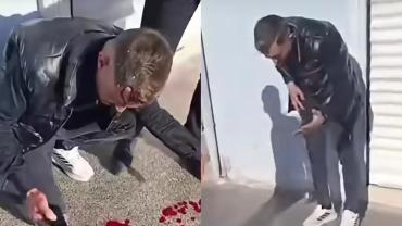 Binadan Kopan Beton Parçası Vatandaşı Ağır Yaraladı